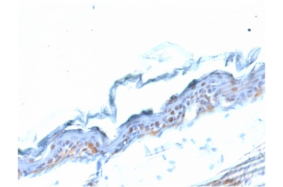 Immunohistochemistry - Anti-SOX2 Antibody [SOX2/1791] (A250002) - Antibodies.com