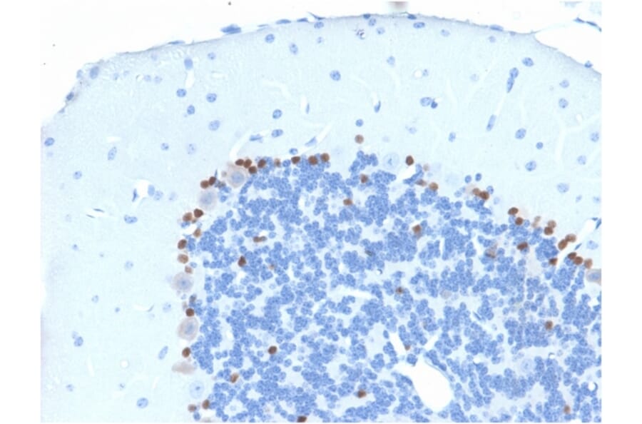 Immunohistochemistry - Anti-SOX2 Antibody [SOX2/1791] (A250002) - Antibodies.com