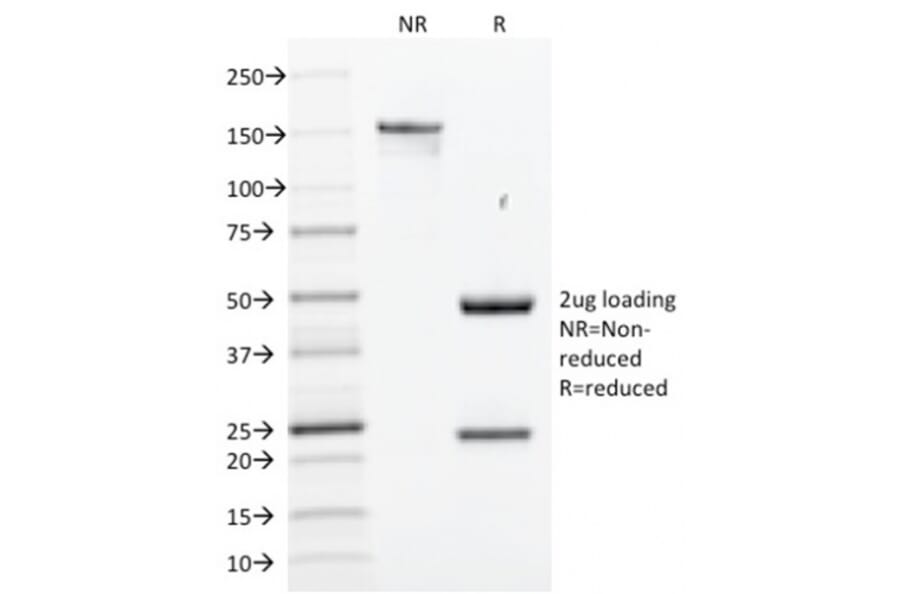 SDS-PAGE - Anti-SOX2 Antibody [SOX2/1791] (A250002) - Antibodies.com