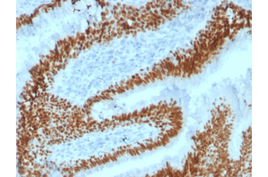 Immunohistochemistry - Anti-SOX2 Antibody [SOX2/1792] (A250003) - Antibodies.com