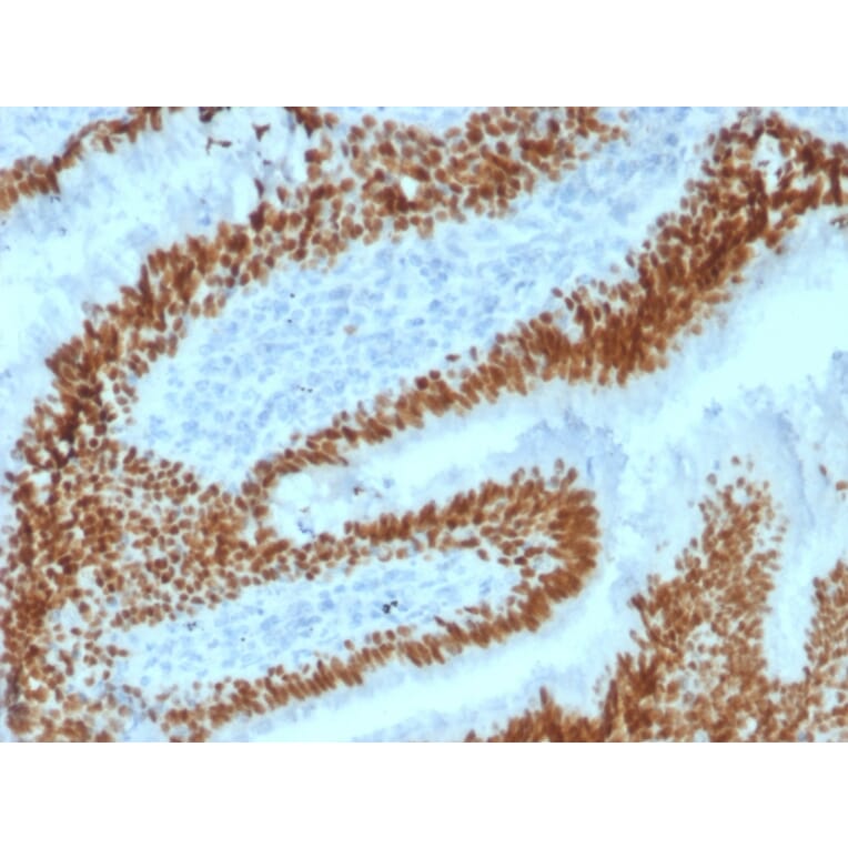 Immunohistochemistry - Anti-SOX2 Antibody [SOX2/1792] (A250003) - Antibodies.com