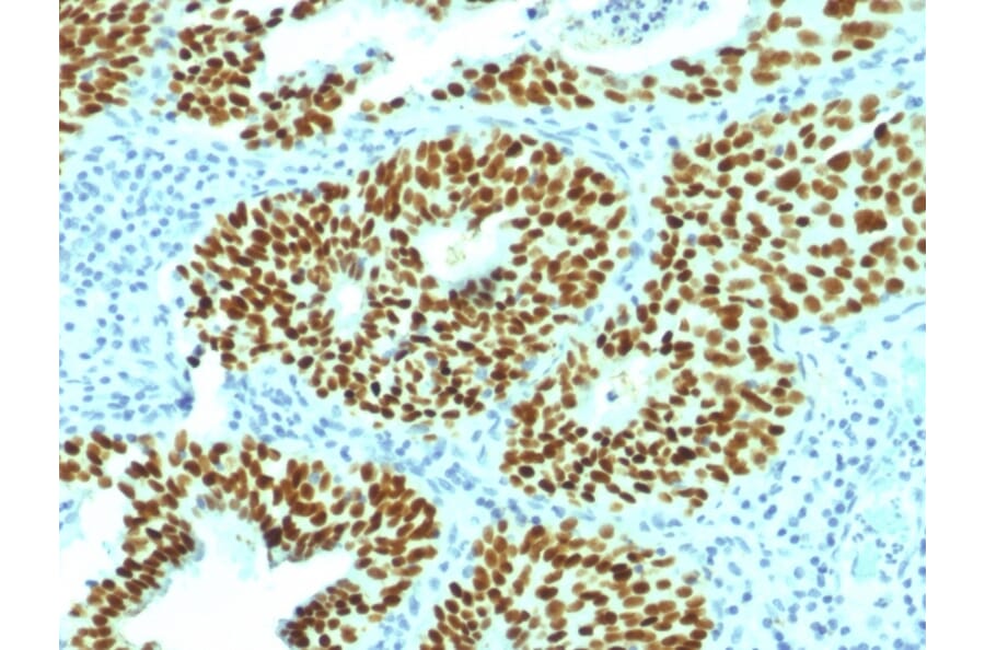 Immunohistochemistry - Anti-SOX2 Antibody [SOX2/1792] (A250003) - Antibodies.com
