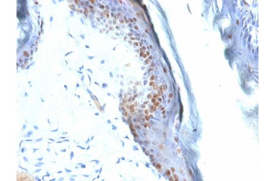 Immunohistochemistry - Anti-SOX2 Antibody [SOX2/1792] (A250003) - Antibodies.com