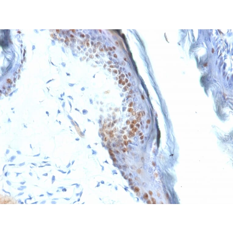 Immunohistochemistry - Anti-SOX2 Antibody [SOX2/1792] (A250003) - Antibodies.com
