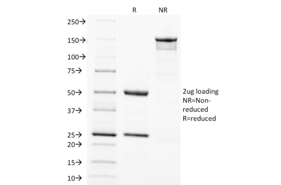 SDS-PAGE - Anti-SOX2 Antibody [SOX2/1792] (A250003) - Antibodies.com