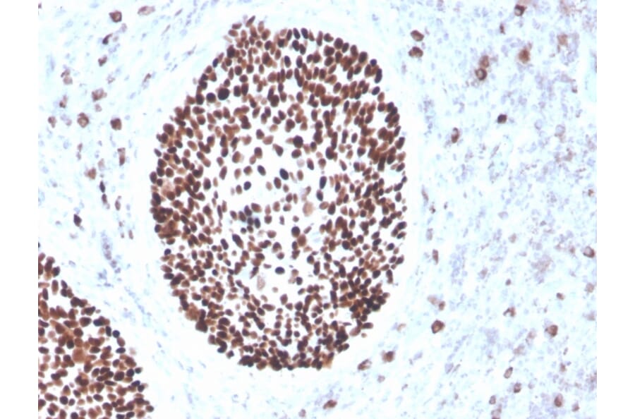 Immunohistochemistry - Anti-SOX2 Antibody [rSOX2/1791] (A250003) - Antibodies.com