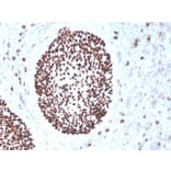 Immunohistochemistry - Anti-SOX2 Antibody [rSOX2/1791] (A250003) - Antibodies.com