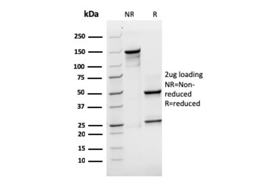 SDS-PAGE - Anti-SOX2 Antibody [rSOX2/1791] (A250004) - Antibodies.com