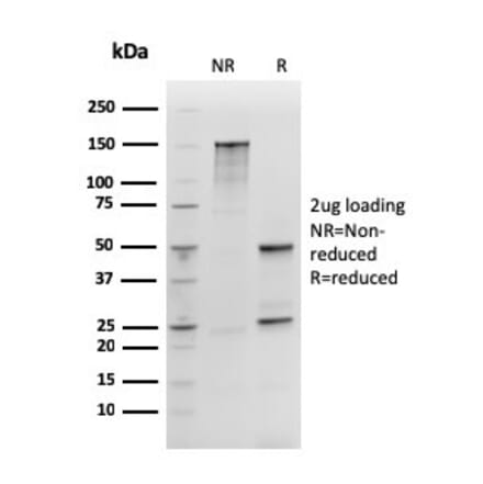 SDS-PAGE - Anti-SOX2 Antibody [rSOX2/1792] (A250005) - Antibodies.com
