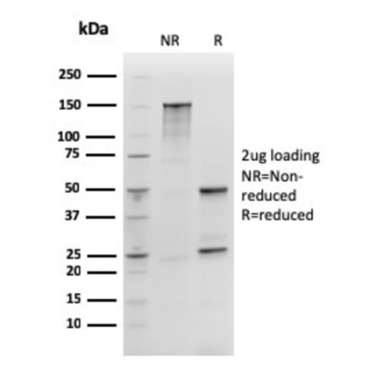 SDS-PAGE - Anti-SOX2 Antibody [rSOX2/1792] (A250005) - Antibodies.com
