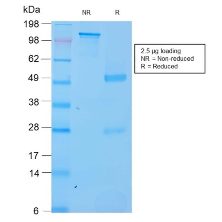 SDS-PAGE - Anti-SOX2 Antibody [SOX2/3169R] (A250006) - Antibodies.com