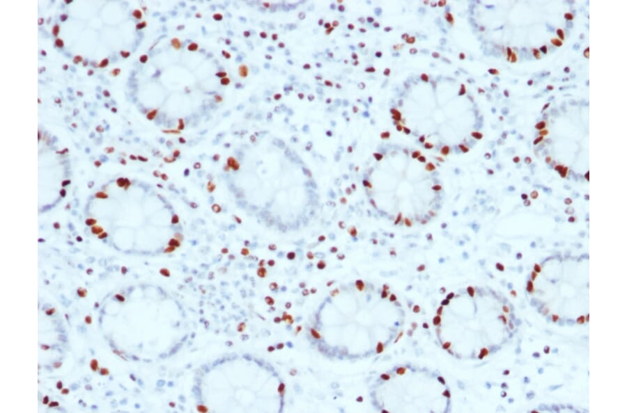 Immunohistochemistry - Anti-SOX4 Antibody [SOX4/2540] (A250008) - Antibodies.com