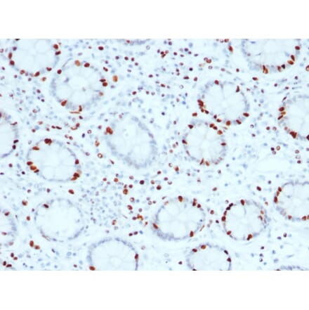 Immunohistochemistry - Anti-SOX4 Antibody [SOX4/2540] (A250008) - Antibodies.com