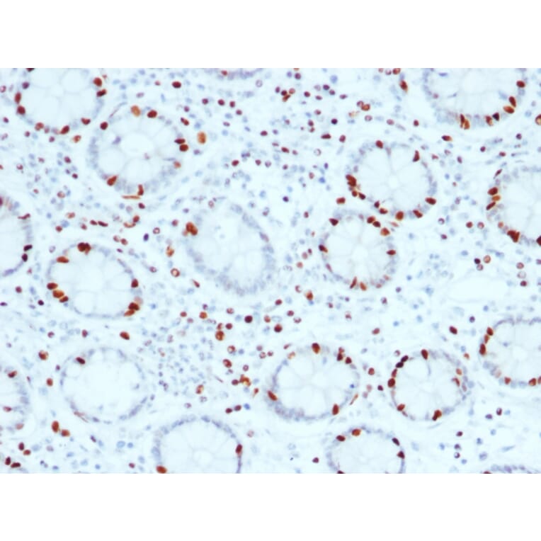 Immunohistochemistry - Anti-SOX4 Antibody [SOX4/2540] (A250008) - Antibodies.com