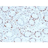 Immunohistochemistry - Anti-SOX4 Antibody [SOX4/2540] (A250008) - Antibodies.com