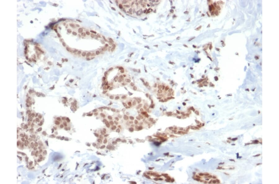 Immunohistochemistry - Anti-SOX4 Antibody [SOX4/2540] (A250008) - Antibodies.com