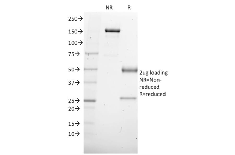 SDS-PAGE - Anti-SOX4 Antibody [SOX4/2540] (A250008) - Antibodies.com