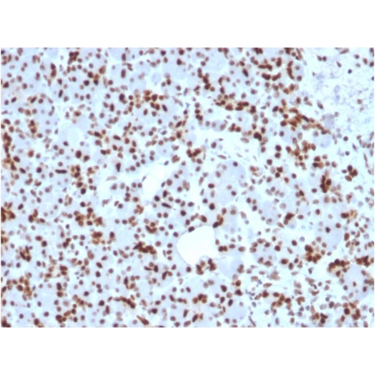Immunohistochemistry - Anti-SOX9 Antibody [SOX9/2398] (A250009) - Antibodies.com
