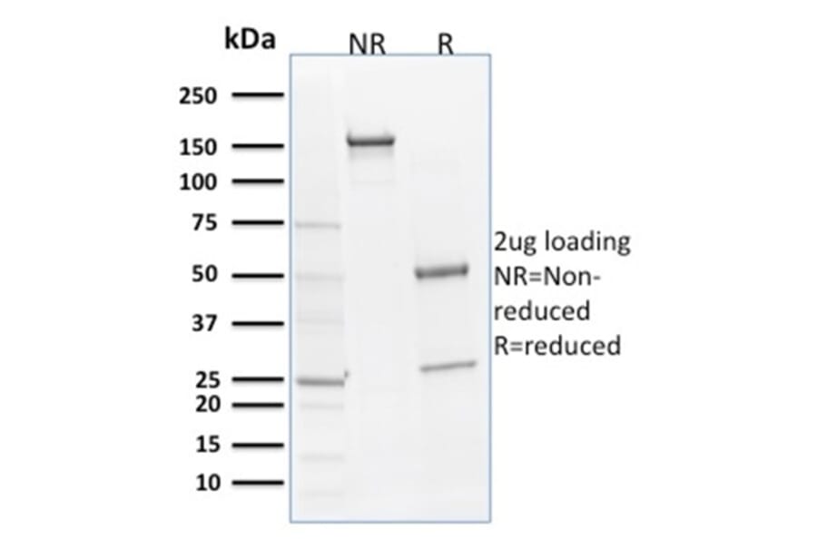 SDS-PAGE - Anti-SOX9 Antibody [SOX9/2398] (A250009) - Antibodies.com