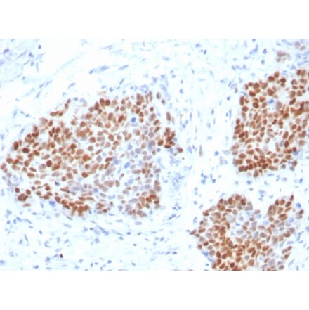 Immunohistochemistry - Anti-SOX9 Antibody [SOX9/3916R] (A250009) - Antibodies.com