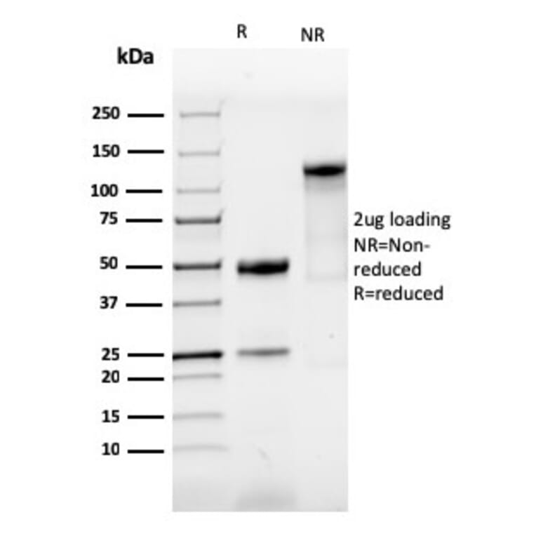 SDS-PAGE - Anti-SOX9 Antibody [SOX9/3916R] (A250010) - Antibodies.com