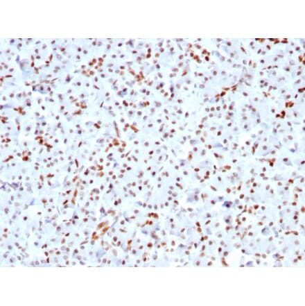 Immunohistochemistry - Anti-SOX9 Antibody [SOX9/3141R] (A250011) - Antibodies.com