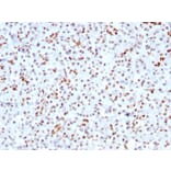 Immunohistochemistry - Anti-SOX9 Antibody [SOX9/3141R] (A250011) - Antibodies.com