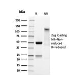 SDS-PAGE - Anti-SOX9 Antibody [SOX9/3141R] (A250012) - Antibodies.com
