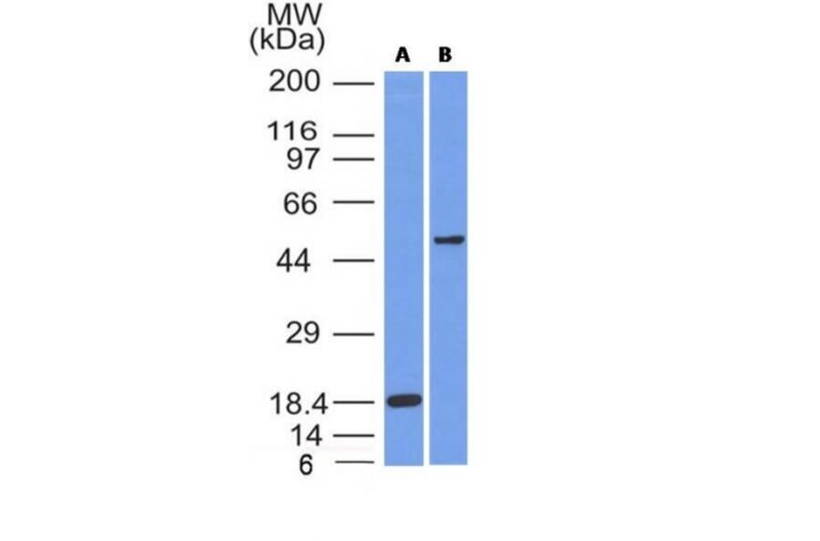 Western Blot - Anti-SOX10 Antibody [SOX10/991] (A250013) - Antibodies.com