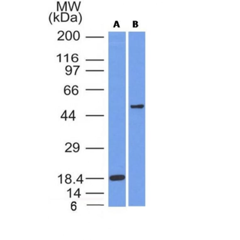 Western Blot - Anti-SOX10 Antibody [SOX10/991] (A250013) - Antibodies.com