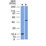 Western Blot - Anti-SOX10 Antibody [SOX10/991] (A250013) - Antibodies.com