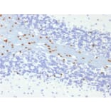 Immunohistochemistry - Anti-SOX10 Antibody [SOX10/991] (A250013) - Antibodies.com