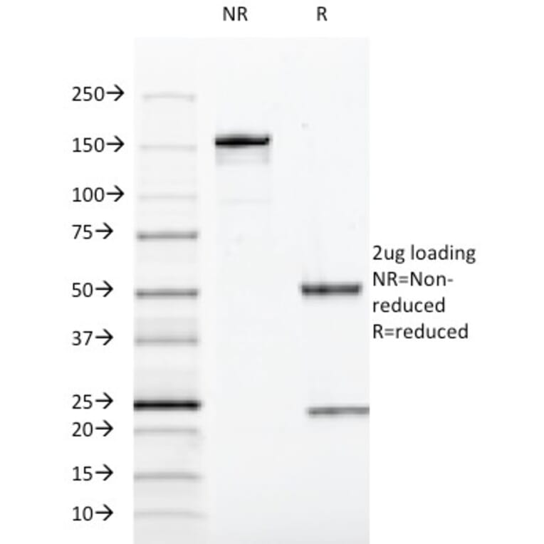 SDS-PAGE - Anti-SOX10 Antibody [SOX10/991] (A250013) - Antibodies.com