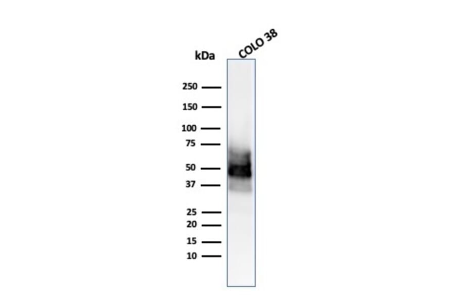 Western Blot - Anti-SOX10 Antibody [SOX10/991] (A250013) - Antibodies.com