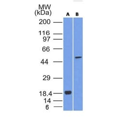 Western Blot - Anti-SOX10 Antibody [SOX10/992] (A250014) - Antibodies.com