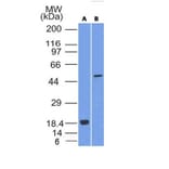 Western Blot - Anti-SOX10 Antibody [SOX10/992] (A250014) - Antibodies.com