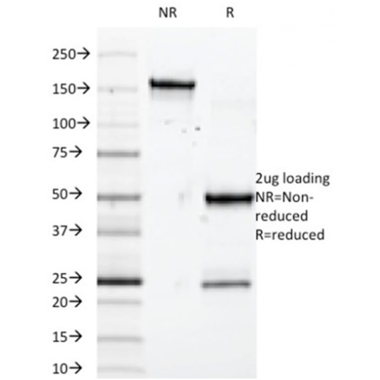 SDS-PAGE - Anti-SOX10 Antibody [SOX10/992] (A250014) - Antibodies.com