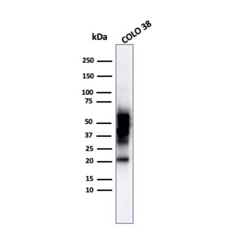 Western Blot - Anti-SOX10 Antibody [SOX10/992] (A250014) - Antibodies.com