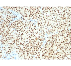 Immunohistochemistry - Anti-SOX10 Antibody [SOX10/1074] (A250015) - Antibodies.com