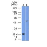 Western Blot - Anti-SOX10 Antibody [SOX10/1074] (A250015) - Antibodies.com