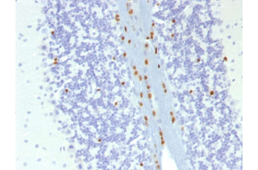 Immunohistochemistry - Anti-SOX10 Antibody [SOX10/1074] (A250015) - Antibodies.com
