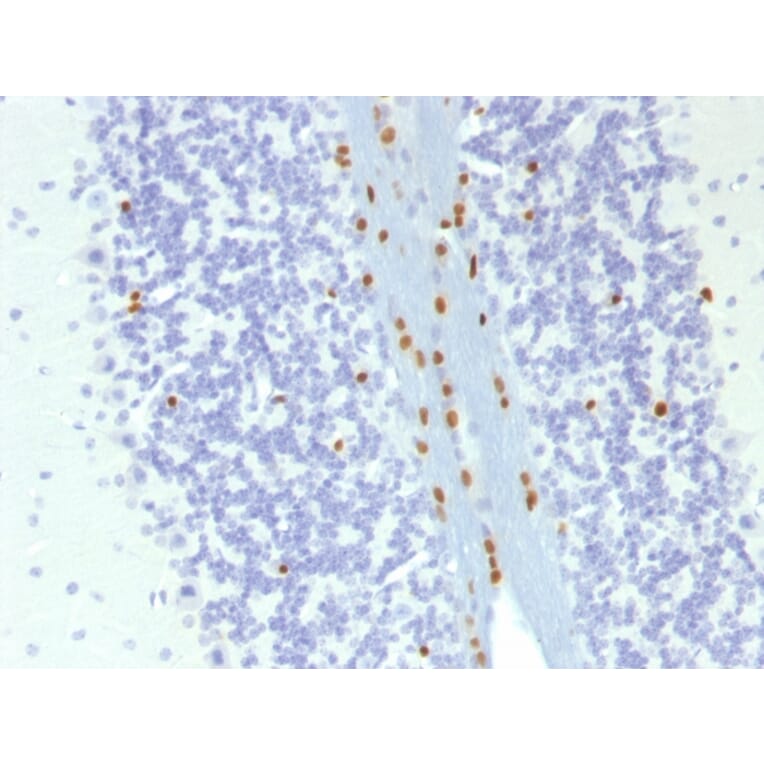 Immunohistochemistry - Anti-SOX10 Antibody [SOX10/1074] (A250015) - Antibodies.com