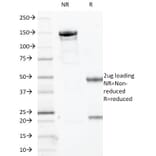 SDS-PAGE - Anti-SOX10 Antibody [SOX10/1074] (A250015) - Antibodies.com