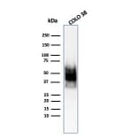 Western Blot - Anti-SOX10 Antibody [SOX10/1074] (A250015) - Antibodies.com