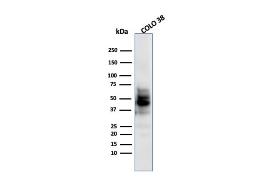Western Blot - Anti-SOX10 Antibody [SPM607] (A250016) - Antibodies.com