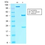 SDS-PAGE - Anti-SOX10 Antibody [rSOX10/1074] (A250017) - Antibodies.com