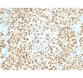 Immunohistochemistry - Anti-SOX10 Antibody [SOX10/2311R] (A250019) - Antibodies.com