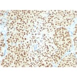 Immunohistochemistry - Anti-SOX10 Antibody [SOX10/2311R] (A250019) - Antibodies.com