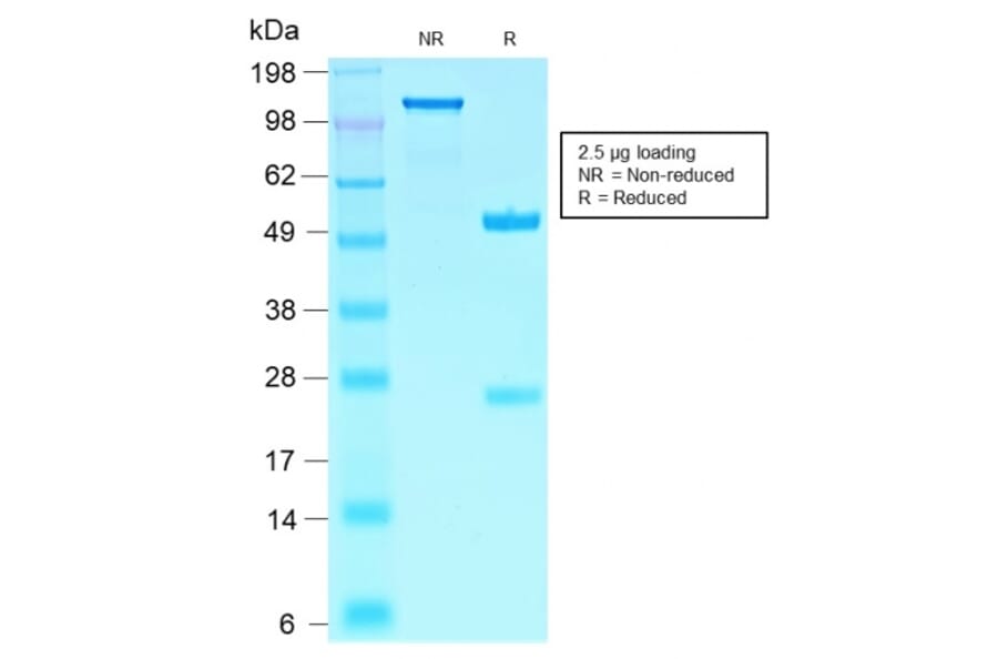 SDS-PAGE - Anti-SOX10 Antibody [SOX10/2311R] (A250019) - Antibodies.com