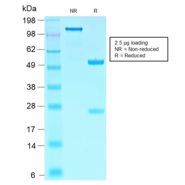 SDS-PAGE - Anti-SOX10 Antibody [SOX10/2311R] (A250019) - Antibodies.com